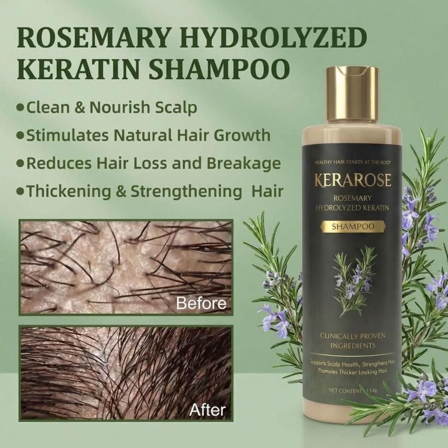Rosemary Hair Growth Shampoo with Hydrolyzed Keratin 114gm Each (Pack of 2)
